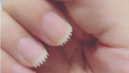 指甲为什么总长进肉里?只因大多数人都做错了这个动作