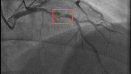 同一天，两位38岁宝爸带娃运动后倒下